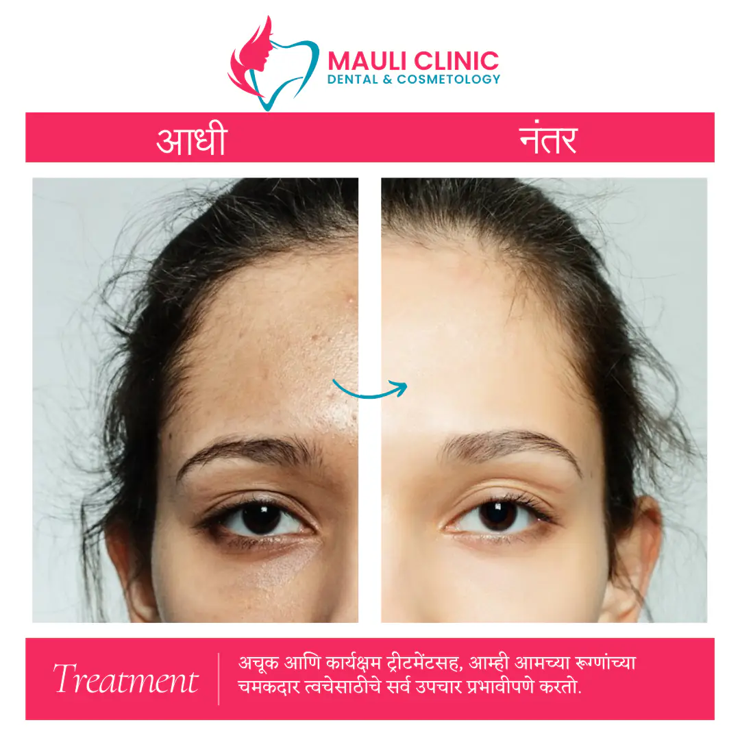 Mauli Skin Hair Laser and Advance Dental clinic - Image 4